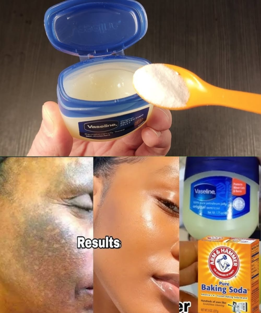Combine Baking Soda with Vaseline: A Quick and Effective Solution!
