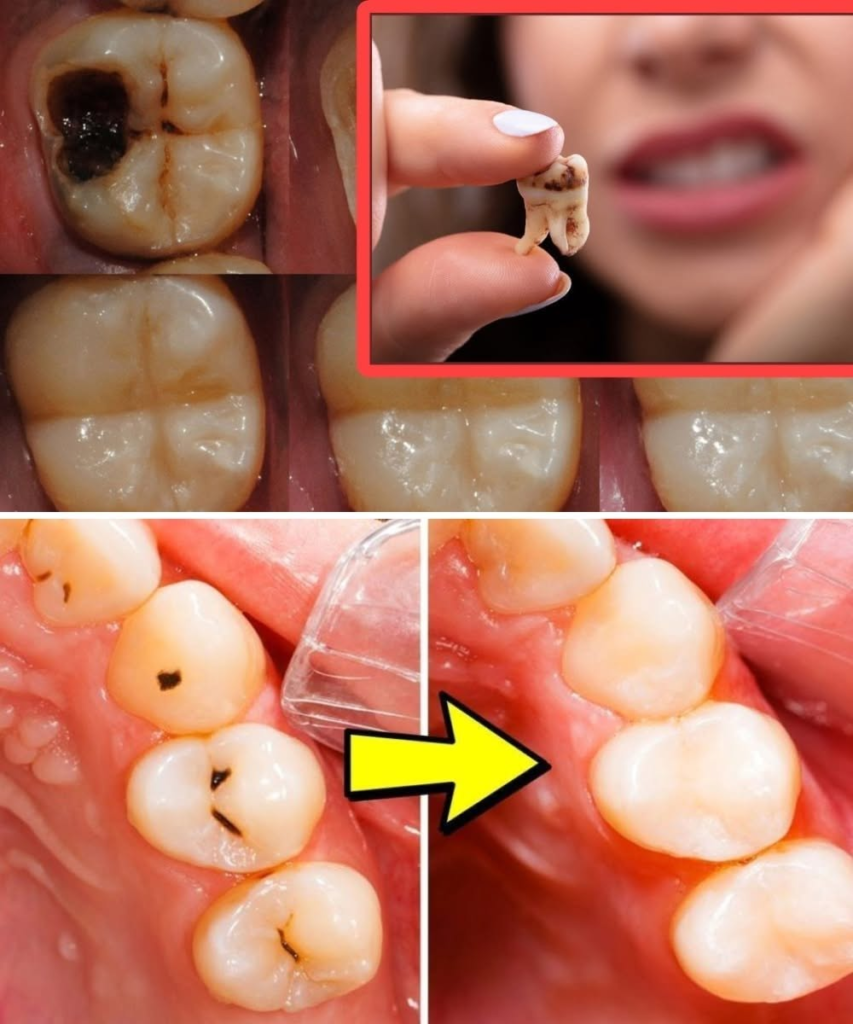 Cavities Prevention: Simple Habits Dentists Actually Recommend