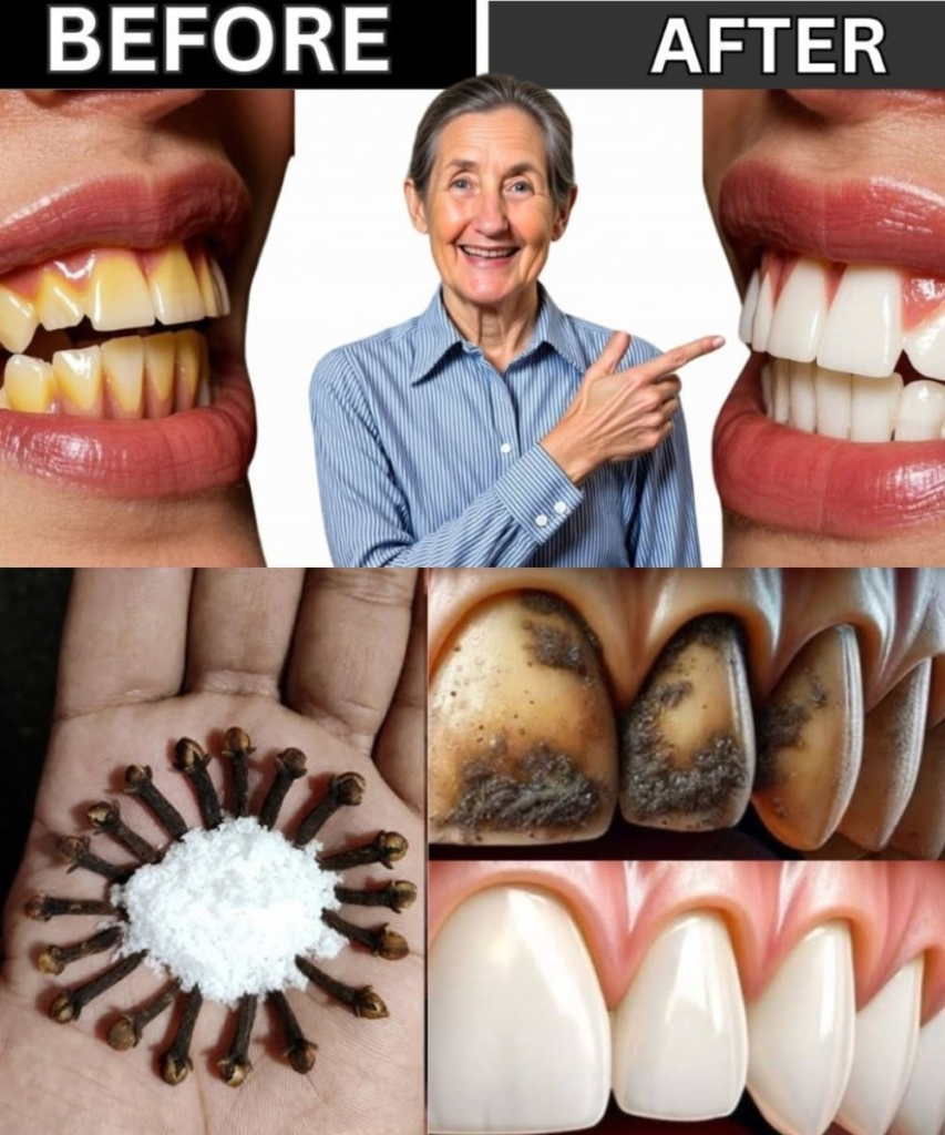 Chewing Cloves Daily: How Many and What Is the Best Time?