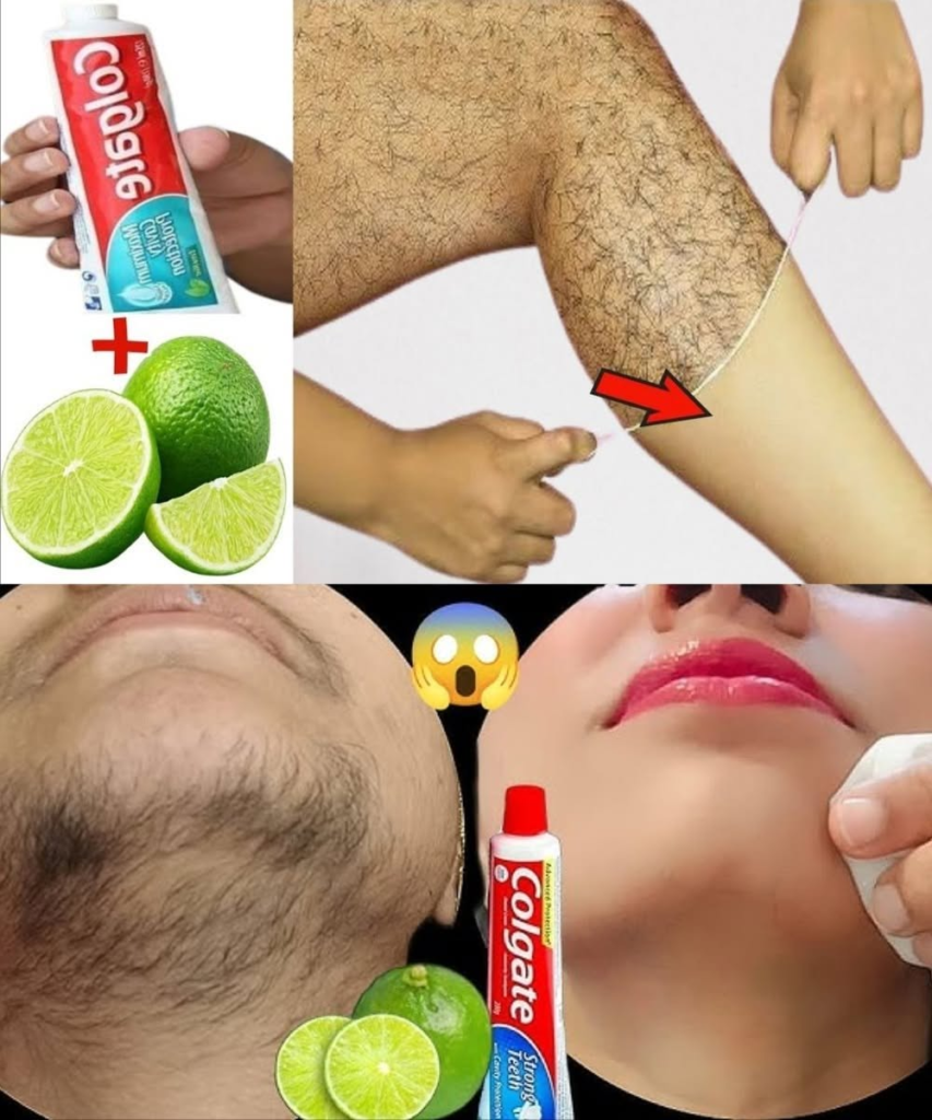 Permanent Body Hair Removal Naturally? Here’s What’s Realistic