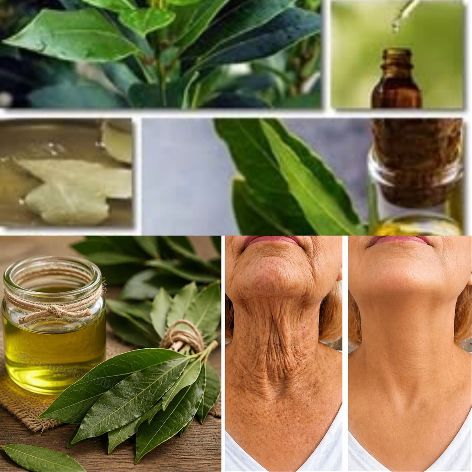 This Oil Heals Everything! 100,000 Times More Powerful! A True Treasure From Nature — Bay Leaf Oil