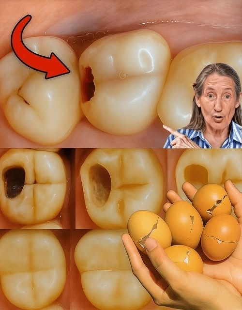 Unlock a Dazzling Smile with Eggshells: Nature’s Hidden Secret for Whiter, Stronger Teeth!