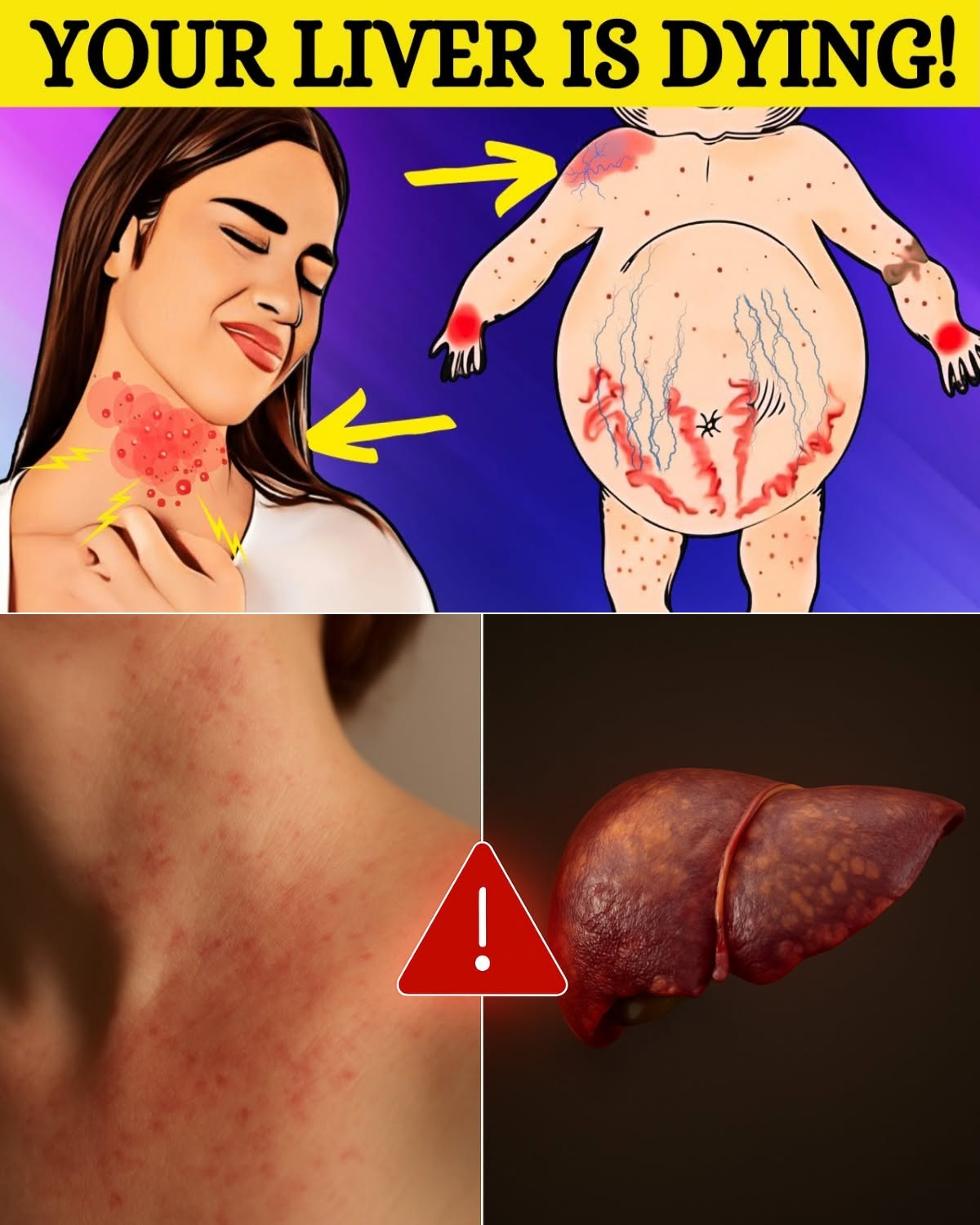 Silent Threat: 8 Subtle Signs That May Point to Fatty Liver Disease
