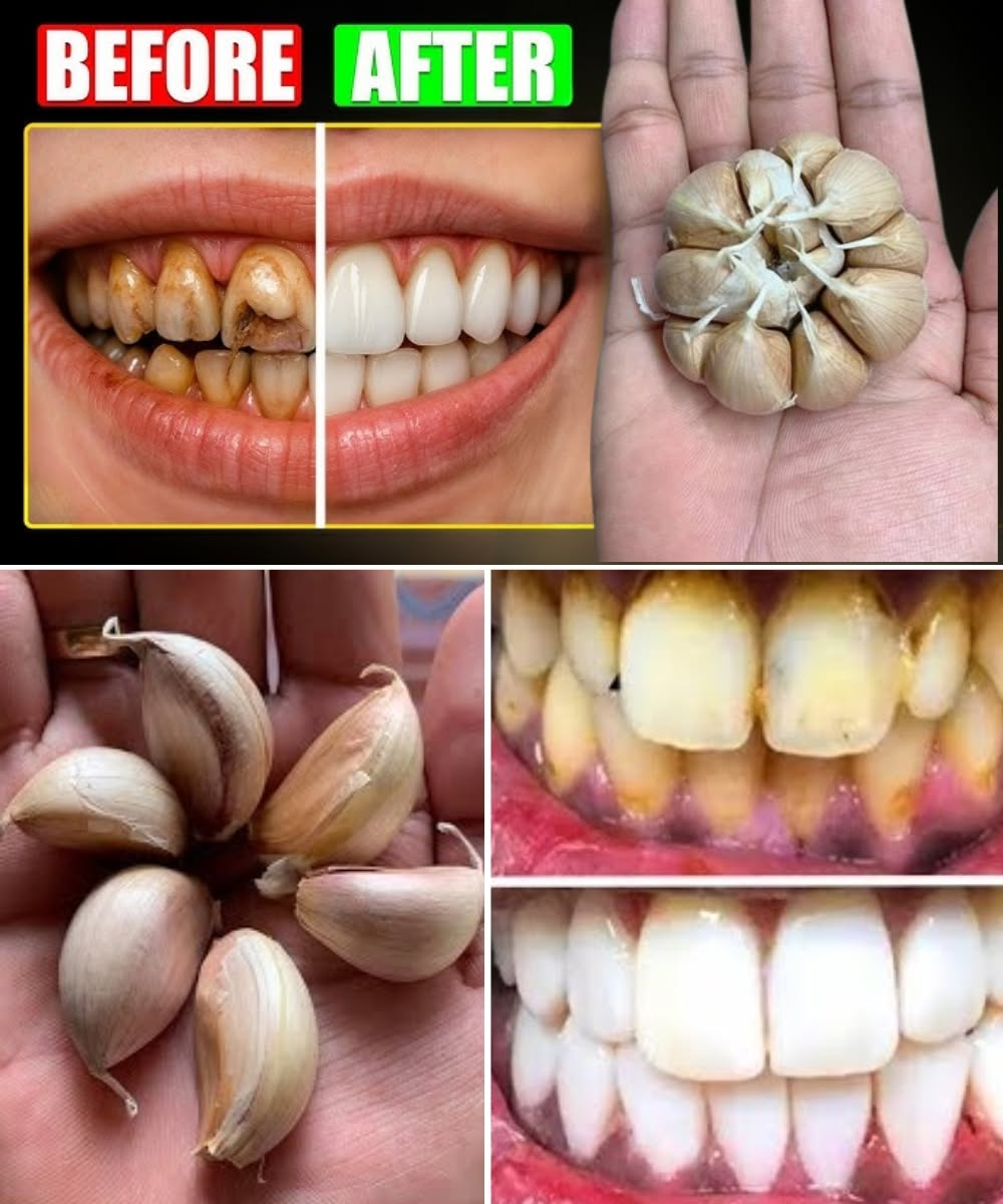 A Simple and Natural Solution for Better Oral Health