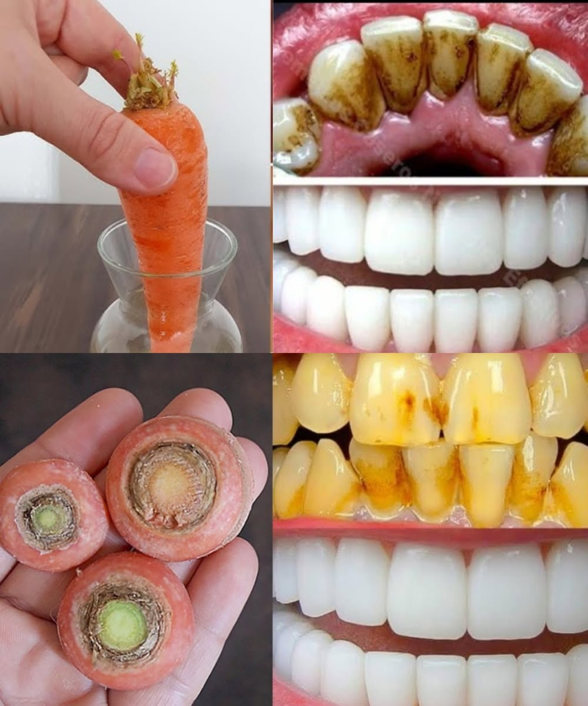 Brighten Your Smile Naturally—With Carrot Tops!