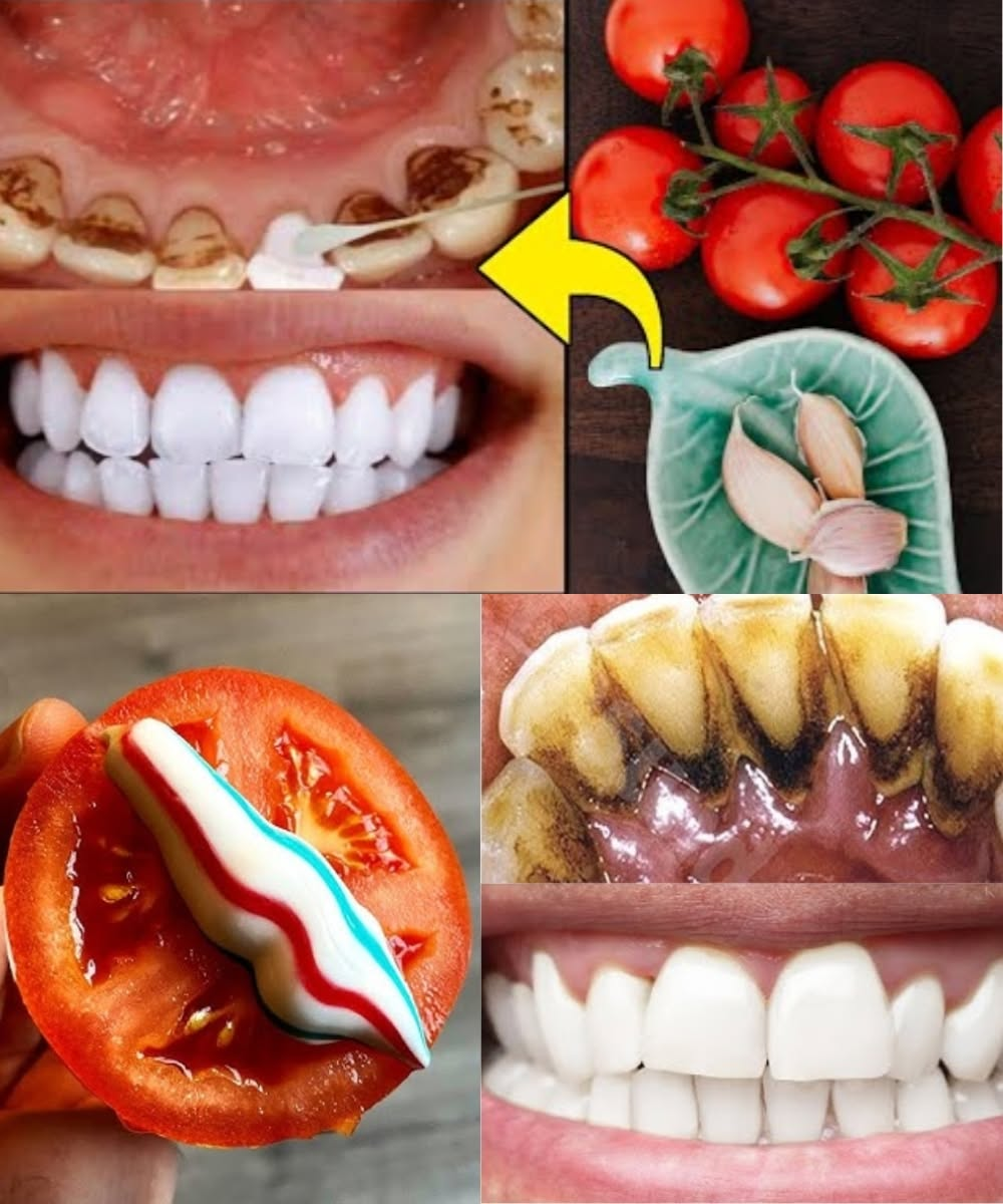 The Strongest Teeth Whitening Recipe at Home in Just 2 Minutes: Naturally Remove Yellow Tartar with Tomatoes!