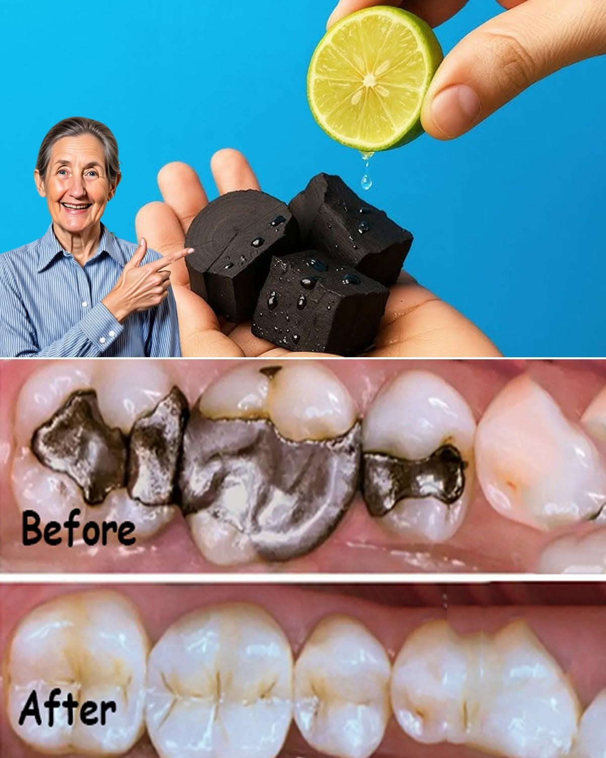 Natural Ways to Protect and Repair Your Teeth