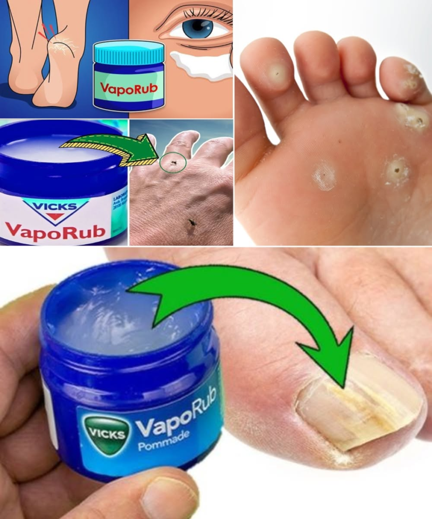 8 Surprising Uses of Vicks VapoRub You Need to Try!