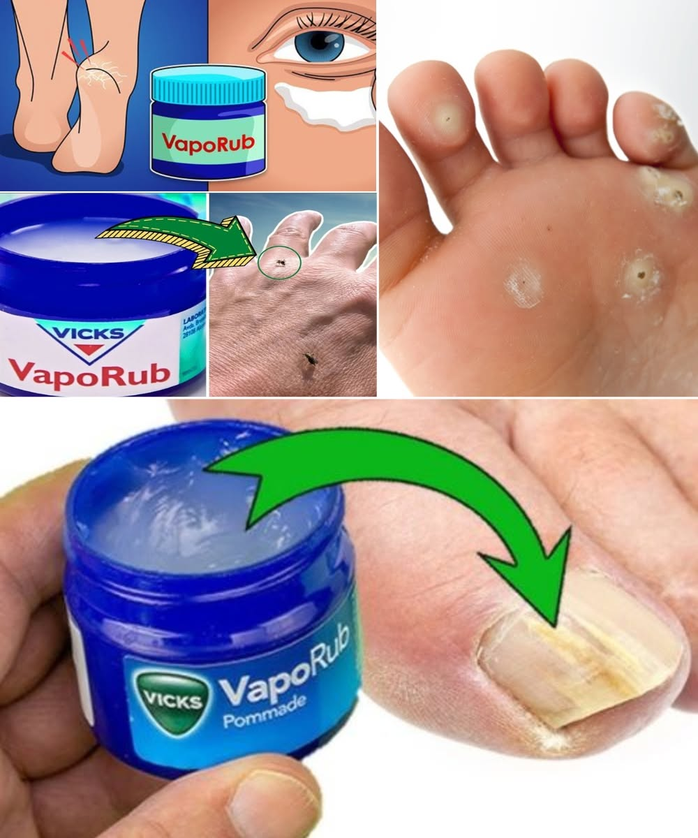 8 Surprising Uses of Vicks VapoRub You Need to Try!