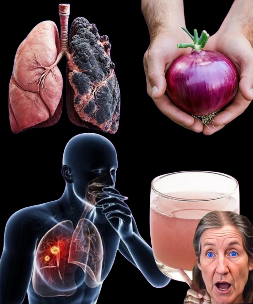 Persistent Cough, Mucus Buildup, or Lung Congestion? Try This Powerful Natural Onion Remedy