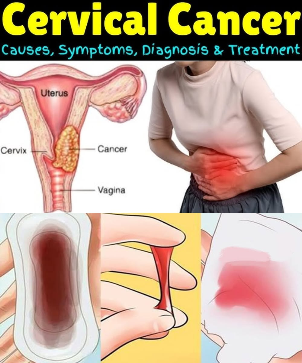 12 Warning Signs Your Uterus Is Crying for Help – Don’t Ignore These Symptoms