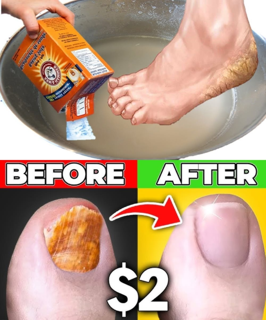 How to Use Baking Soda to Treat Foot Calluses, Odor, and Cracked Heels