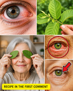 How Guava Can Support Your Eye Health Naturally: Benefits, Safe Uses, and What Science Says
