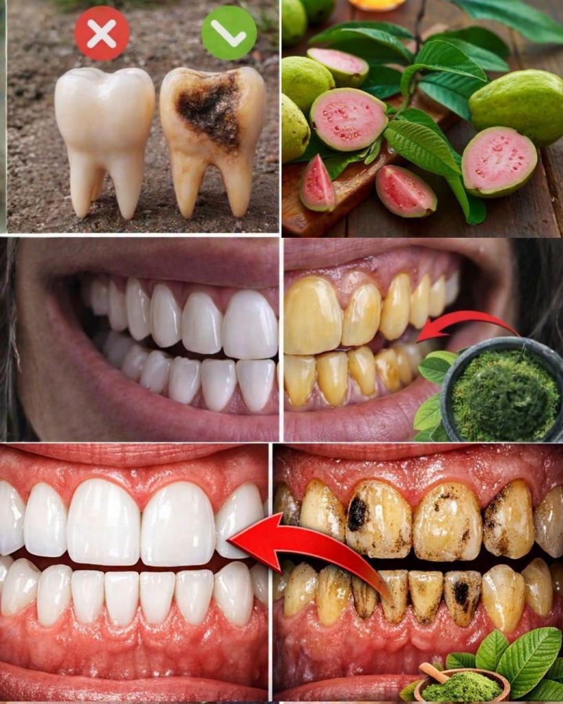 Guava Leaves for Oral Care: 3 Gentle Ways to Use Them at Home