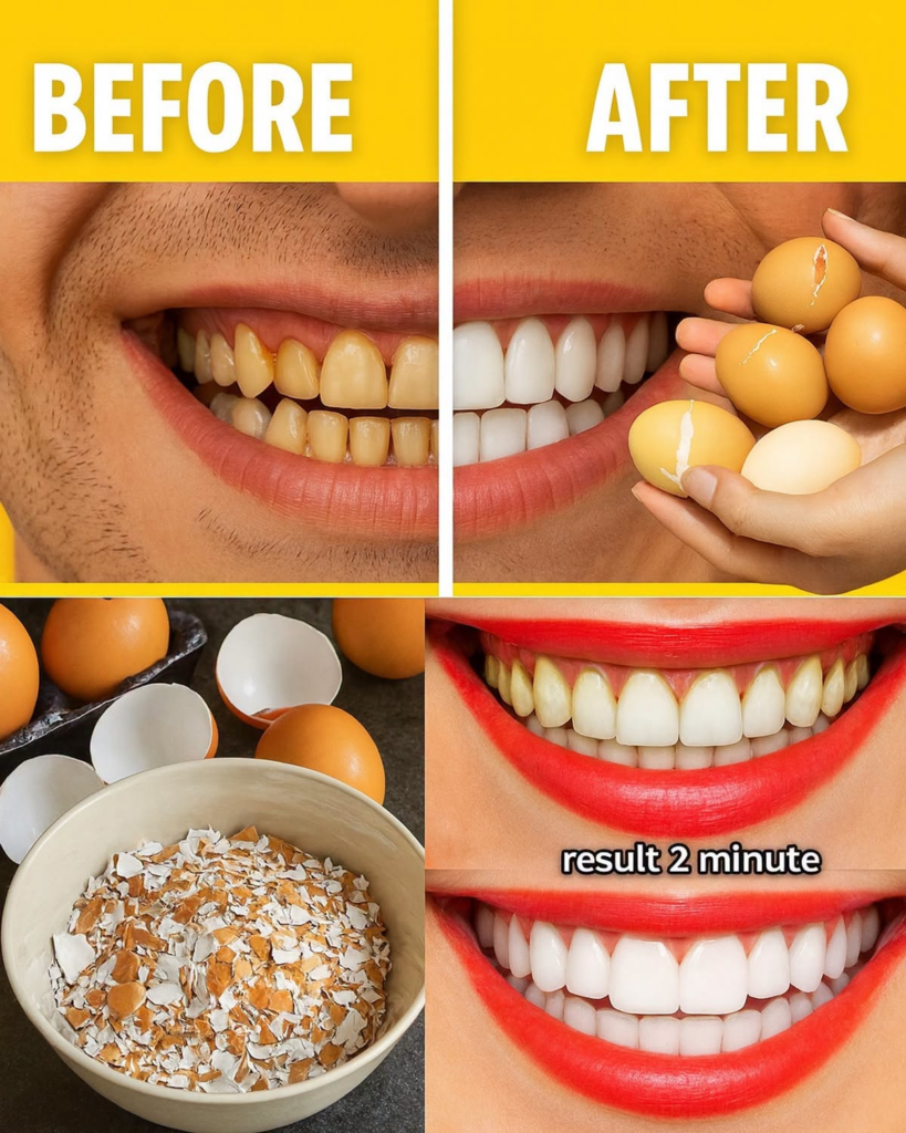 Brighten Your Smile with Simple Ingredients