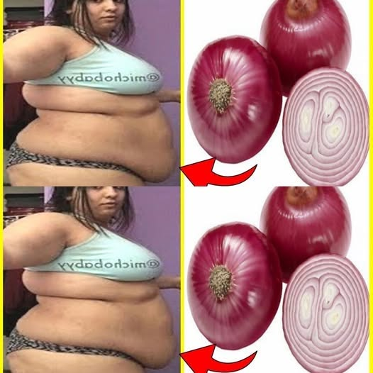How I Lost Belly Fat in 7 Days with Onion: No Strict Diet, No Workout!